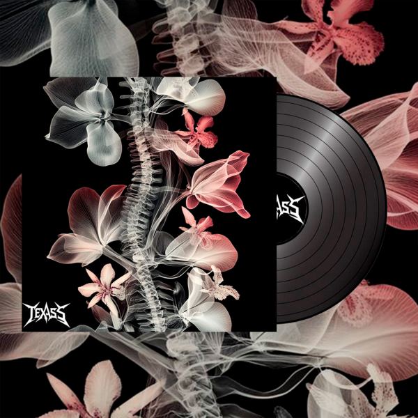 X-Ray