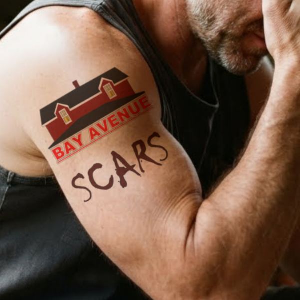 Scars